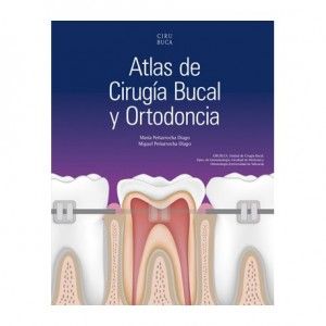 Los avances que se han dado en el campo de la investigación han supuesto un cambio muy rápido en el campo de la cirugía bucal y de la ortodoncia. Este libro ofrece tanto información básica como avanzada para actualizar completamente las nuevas técnicas posibles. Este Atlas de Cirugía Bucal y Ortodoncia es un punto de partida que asientan las bases del desarrollo en el campo. Los contenidos de este libro son diversos, pero el tratamiento y el desarrollo de los temas se caracterizan por su profundidad. Algunos temas que se tratan son las distintas posibilidades terapéuticas para el tratamiento de los dientes incluidos, la relación entre inclusiones de cordales y los problemas ortodóncicos o el tratamiento de los dientes supernumerarios, entre muchos otros apartados. Este atlas va dirigido a los profesionales, a los estudiantes de postgrado y de pregrado y a todos aquellos profesionales y estudiantes de campos relacionados que precisen tener conocimientos sobre el manejo adecuado de pacientes en tratamiento de ortodoncia.